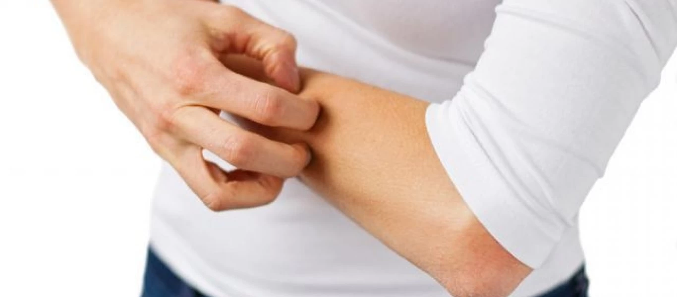 Δερματίτιδα στα χέρια: Όλα όσα πρέπει να γνωρίζετε για τα είδη της και πως να την αντιμετωπίσετε